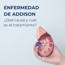 banner del curso: addison y autoinmunidad: estrategias de herbolaria y acupuntura
