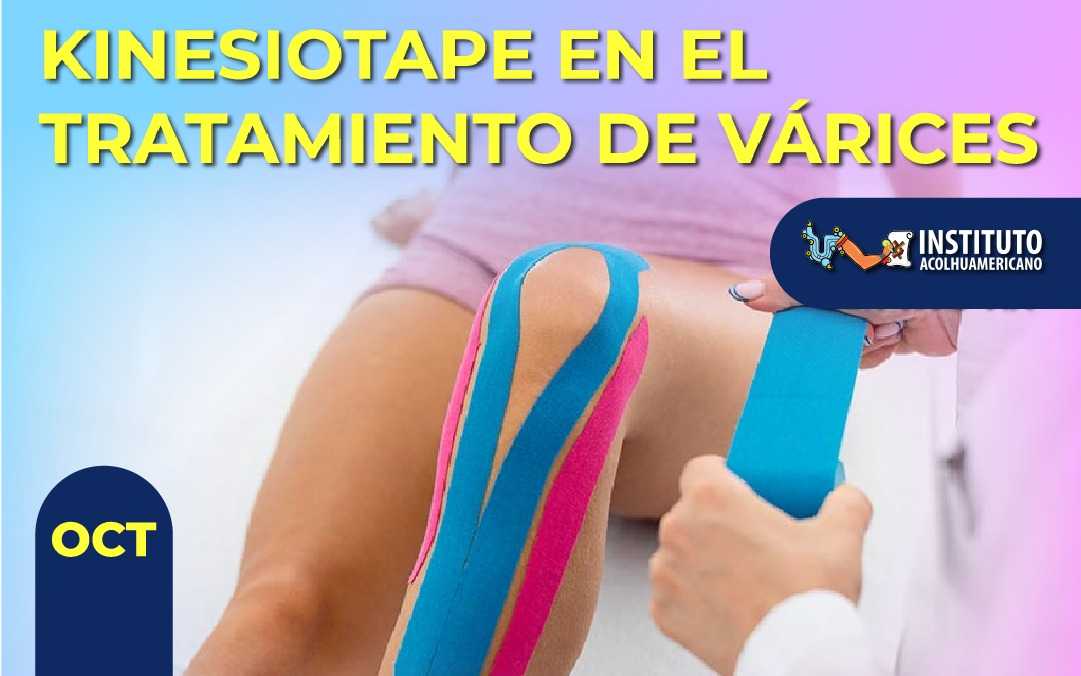 banner del curso: kinesiotape en el tratamiento de varices