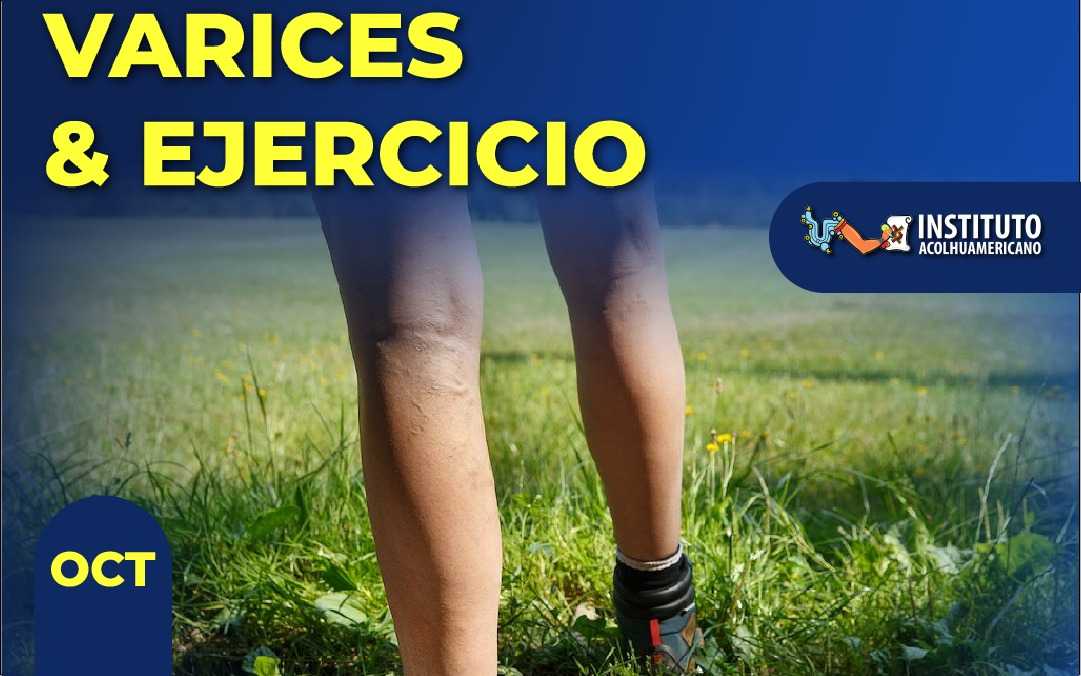 banner del curso: varices y ejercicio