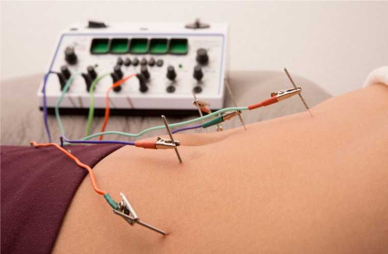 banner del curso: electro acupuntura y anestesia 